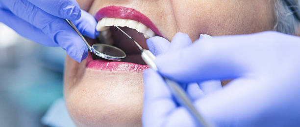 Best Emergency Dental Filling Replacement  in Mount Pleasant, PA